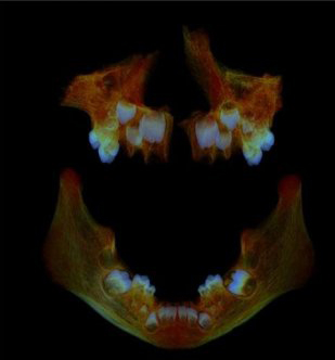 Anglo Saxon teeth